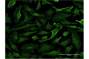 Immunofluorescence of monoclonal antibody to SRGAP1 on HeLa cell.