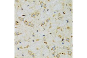 Immunohistochemistry of paraffin-embedded rat brain using SRP19 antibody (ABIN2560139) at dilution of 1:100 (40x lens). (SRP19 antibody)