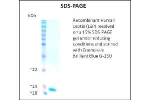 SDS-PAGE (SDS) image for Leptin (LEP) (Active) protein (ABIN5509495)