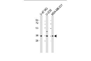 All lanes : Anti-OR2AE1 Antibody (C-term) at 1:1000 dilution Lane 1: U-87 MG whole cell lysate Lane 2: U-2OS whole cell lysate Lane 3: MDA-MB-231 whole cell lysate Lysates/proteins at 20 μg per lane. (Olfactory Receptor, Family 2, Subfamily AE, Member 1 (OR2AE1) (AA 278-312), (C-Term) antibody)