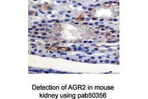 Image no. 2 for anti-Anterior Gradient Homolog 2 (Xenopus Laevis) (AGR2) (AA 1-50), (N-Term) antibody (ABIN363665)