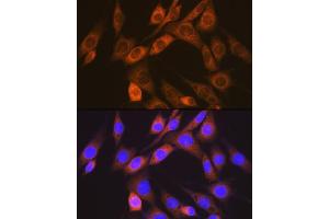Immunofluorescence analysis of NIH-3T3 cells using  Rabbit mAb (ABIN7265412) at dilution of 1:100 (40x lens). (ACVRL1 antibody)