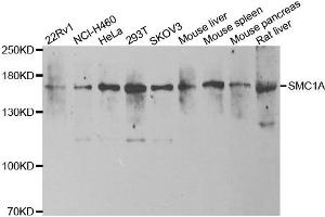 Western blot analysis of extracts of various cell lines, using SMC1A antibody. (SMC1A antibody)