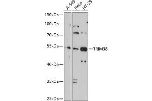 Western blot analysis of extracts of various cell lines, using TRIM38 antibody (ABIN1683145, ABIN3016312, ABIN3016313 and ABIN6219714) at 1:1000 dilution. (TRIM38 antibody  (AA 266-465))
