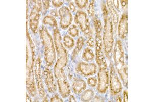 Immunohistochemistry of paraffin-embedded Mouse kidney using GM130 antibody (ABIN6129789, ABIN6141264, ABIN6141265 and ABIN6220979) at dilution of 1:25 (40x lens). (Golgin A2 (GOLGA2) (AA 20-300) antibody)