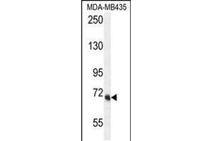 Western blot analysis in MDA-MB435 cell line lysates (35ug/lane). (VPS52 antibody  (C-Term))