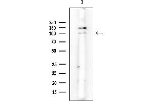 anti-phosphofructokinase, Muscle (PFKM) (N-Term) antibody