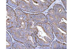 IHC analysis of MRPS22 using anti-MRPS22 antibody (ABIN7600613). (MRPS22 antibody  (AA 21-329))