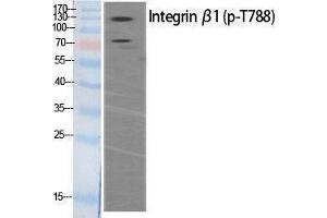 Western Blotting (WB) image for anti-Integrin beta 1 (ITGB1) (pThr788) antibody (ABIN3179455) (ITGB1 antibody  (pThr788))