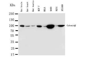 Anti-beta Catenin antibody, Western blotting Lane 1: Rat Brain Tissue Lysate Lane 2: Rat Heart Tissue Lysate Lane 3: Rat Testis Tissue Lysate Lane 4: MCF-7 Cell Lysate Lane 5: HELA Cell Lysate Lane 6: M453 Cell Lysate Lane 7: M231 Cell Lysate  Lane 8: HT1080 Cell Lysate