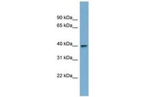 Image no. 1 for anti-Aspartate beta-Hydroxylase Domain Containing 2 (ASPHD2) (AA 107-156) antibody (ABIN6744195) (ASPHD2 antibody  (AA 107-156))