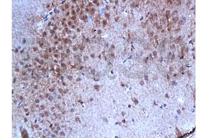 Formalin-fixed and paraffin embedded rat brain tissue with labeled Anti-Phospho-Estrogen Receptor alpha (Ser167) Polyclonal Antibody, Unconjugated (ABIN729493) at 1:200, followed by conjugation to the secondary antibody and DAB staining