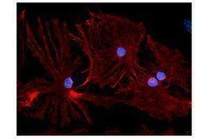 Immunofluorescence (IF) image for anti-Glial Fibrillary Acidic Protein (GFAP) antibody (ABIN2666420) (GFAP antibody)