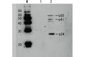 Western Blotting (WB) image for anti-Human Immunodeficiency Virus 1 Capsid (HIV-1 p24) antibody (Biotin) (ABIN2452028) (HIV-1 p24 antibody  (Biotin))