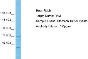 Host: Rabbit Target Name: PAM Sample Type: Stomach Tumor lysates Antibody Dilution: 1. (PAM antibody  (C-Term))