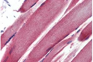 Human Skeletal Muscle (formalin-fixed, paraffin-embedded) stained with GSTM2 antibody ABIN462231 followed by biotinylated goat anti-rabbit IgG secondary antibody ABIN481713, alkaline phosphatase-streptavidin and chromogen. (GSTM2 antibody  (AA 71-120))