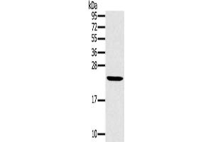 Gel: 12 % SDS-PAGE, Lysate: 40 μg, Lane: Mouse liver tissue, Primary antibody: ABIN7130217(MED22 Antibody) at dilution 1/800, Secondary antibody: Goat anti rabbit IgG at 1/8000 dilution, Exposure time: 15 seconds (MED22 antibody)