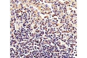 Immunohistochemical analysis of paraffin-embedded human spleen using beta-Actin antibody at 1:25 dilution. (beta Actin antibody)