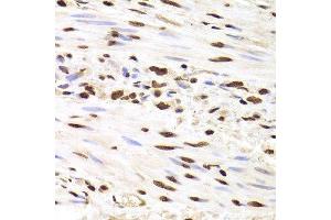 Immunohistochemistry (Paraffin-embedded Sections) (IHC (p)) image for anti-Heterogeneous Nuclear Ribonucleoprotein D (HNRNPD) (AA 1-306) antibody (ABIN6141905)