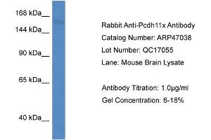 Western Blotting (WB) image for anti-Protocadherin 11 (PCDH11) (Middle Region) antibody (ABIN2782817) (PCDH11X antibody  (Middle Region))