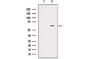Western blot analysis of extracts from HUVEC, using CDC25C Antibody. (CDC25C antibody  (Internal Region))