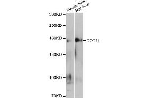 Western blot analysis of extracts of various cell lines, using DOT1L antibody (ABIN6292029) at 1:500 dilution. (DOT1L antibody)