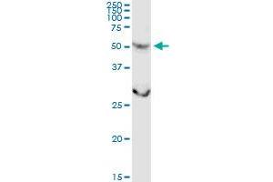 CSGALNACT2 MaxPab rabbit polyclonal antibody. (CSGALNACT2 antibody  (AA 1-542))