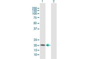 Western Blot analysis of IFNA5 expression in transfected 293T cell line by IFNA5 MaxPab polyclonal antibody. (IFNA5 antibody  (AA 1-189))