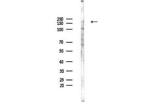Western blot analysis of lysates from EC304 cells, using GRIN2D Antibody at 1/1000 dilution.
