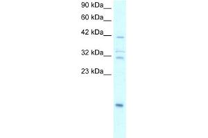 Western Blotting (WB) image for anti-Nuclear Factor of kappa Light Polypeptide Gene Enhancer in B-Cells Inhibitor, alpha (NFKBIA) (N-Term) antibody (ABIN2792665)