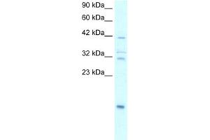 WB Suggested Anti-NFKBIA Antibody Titration:  0. (NFKBIA antibody  (N-Term))