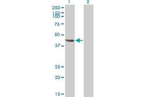 Western Blot analysis of TSG101 expression in transfected 293T cell line by TSG101 monoclonal antibody (M01), clone 5B7.