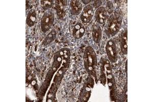 Immunohistochemical staining of human duodenum with MRPS15 polyclonal antibody  strong cytoplasmic positivity in glandular cells at 1:20-1:50 dilution. (MRPS15 antibody)