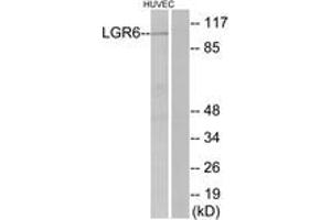 Western blot analysis of extracts from HuvEc cells, using LGR6 Antibody.