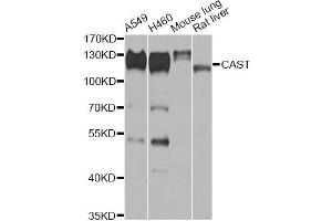 Western blot analysis of extracts of various cell lines, using CAST antibody (ABIN6290228) at 1:1000 dilution.