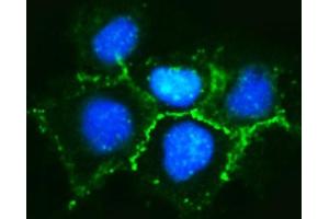 IF analysis of delta 1 Catenin/CAS/CTNND1 using anti-delta 1 Catenin/CAS/CTNND1 antibody (ABIN7602221). (CTNND1 antibody  (AA 64-930))