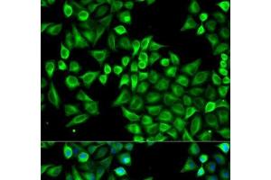 Immunofluorescence analysis of A549 cells using ABAT Polyclonal Antibody