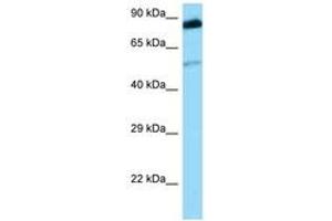 Image no. 1 for anti-Src-Related Kinase Lacking C-Terminal Regulatory Tyrosine and N-Terminal Myristylation Sites (SRMS) (AA 211-260) antibody (ABIN6748403)