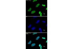Histone H3K27me3 antibody (pAb) tested by immunofluorescence. (Histone 3 antibody  (H3K27me3))