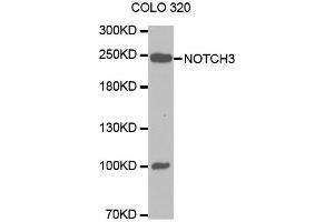 Western blot analysis of extracts of COLO 320 cells lines, using NOTCH3 antibody. (NOTCH3 antibody  (AA 751-850))