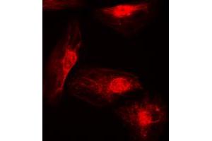 Immunofluorescent analysis of IRF4 staining in A549 cells. (IRF4 antibody  (Center))