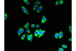 Immunofluorescent analysis of HepG2 cells using ABIN7170223 at dilution of 1:100 and Alexa Fluor 488-congugated AffiniPure Goat Anti-Rabbit IgG(H+L) (SLC35B1 antibody  (AA 106-135))