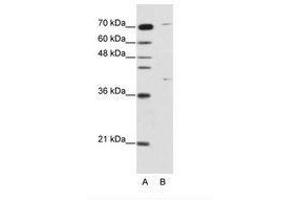 Image no. 1 for anti-Zinc Finger Protein 668 (ZNF668) (C-Term) antibody (ABIN202822) (ZNF668 antibody  (C-Term))