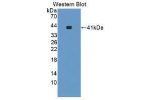 Detection of Recombinant LXRa, Mouse using Polyclonal Antibody to Liver X Receptor Alpha (LXRa) (NR1H3 antibody  (AA 93-432))