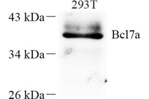 Western blot analysis of Bcl7a (ABIN7073173) at dilution of 1: 250 (BCL7A antibody)