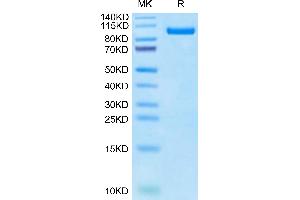 Cynomolgus PTK7 on Tris-Bis PAGE under reduced condition. (PTK7 Protein (AA 39-712) (His tag))