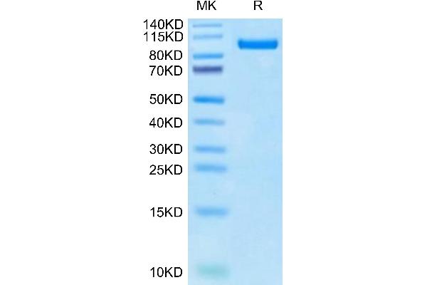 PTK7 Protein (AA 39-712) (His tag)
