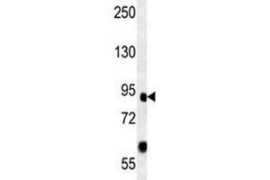 FOXP2 antibody western blot analysis in mouse heart lysate. (FOXP2 antibody  (AA 657-684))