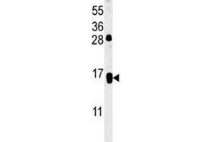 CD69 antibody western blot analysis in HL-60 lysate (CD69 antibody  (AA 119-148))
