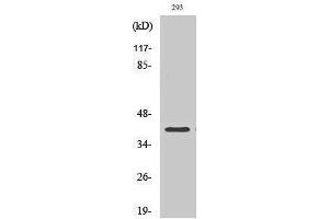 Western Blotting (WB) image for anti-Mitogen-Activated Protein Kinase Kinase 4 (MAP2K4) (C-Term) antibody (ABIN3186893) (MAP2K4 antibody  (C-Term))